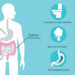 Unhealthy Stomach